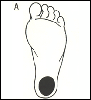 clicca